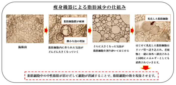 痩身機器による脂肪減少の仕組み